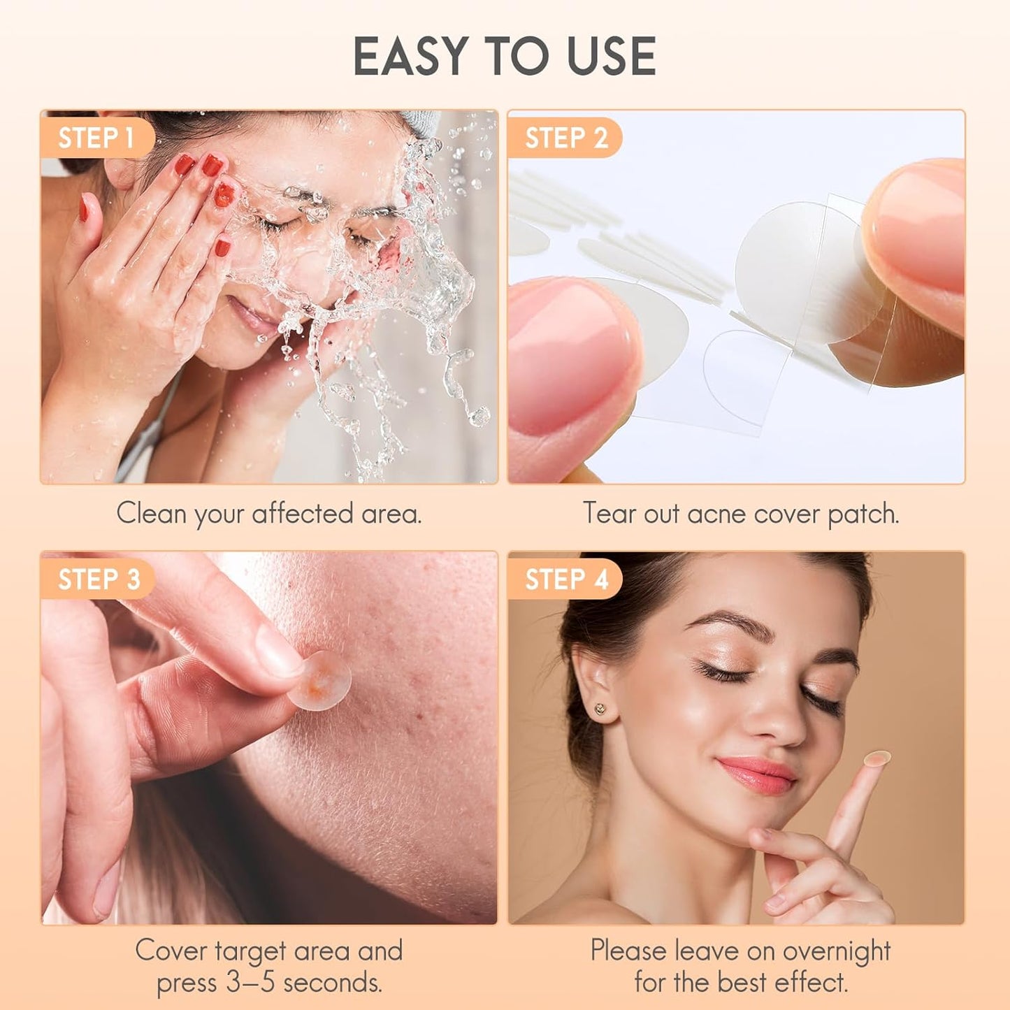 Acne Hydrocolloid Patches, 5 Sizes and 4 Shapes with 186Pcs, the Innovative Size L Suitable Face, Body, Nose, Pimple, Acne Blemishes, with Salicylic Acid, Tea Tree Oil,Centella Asiatica