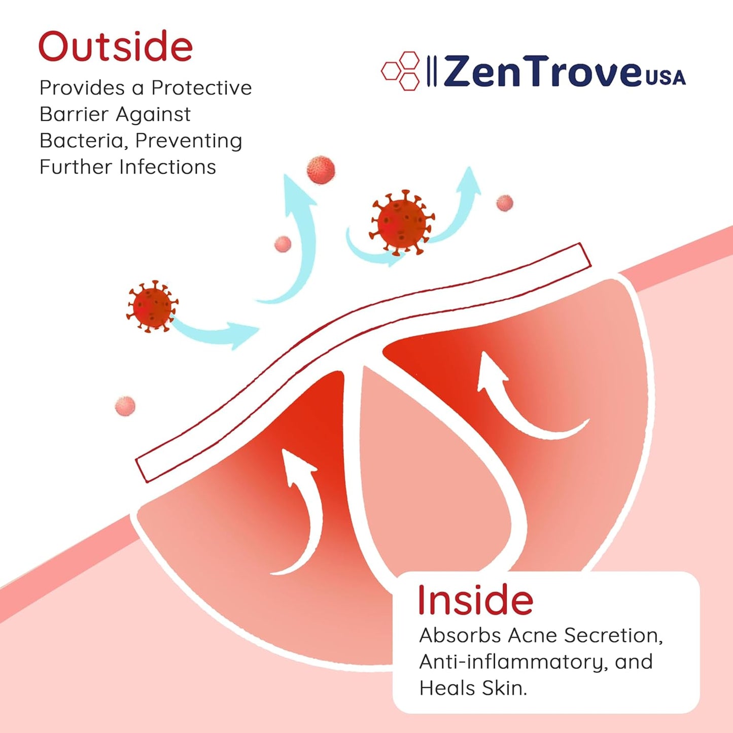 450 Pimple Patches for Face, 4 Size Acne Patches, Hydrocolloid Patches for Covering Zits and Blemishes, Spot Stickers with Salicylic Acid, Glycolic Acid, Tea Tree Oil and Calendula Oil