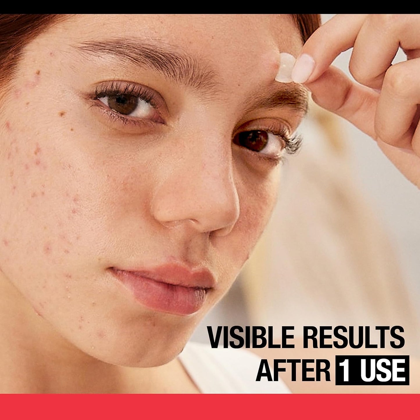 Stubborn Acne Pimple Patches, Acne Treatment for Face, Ultra-Thin Hydrocolloid Spot Stickers Provide Optimal Healing for Pimples, 24 Patches