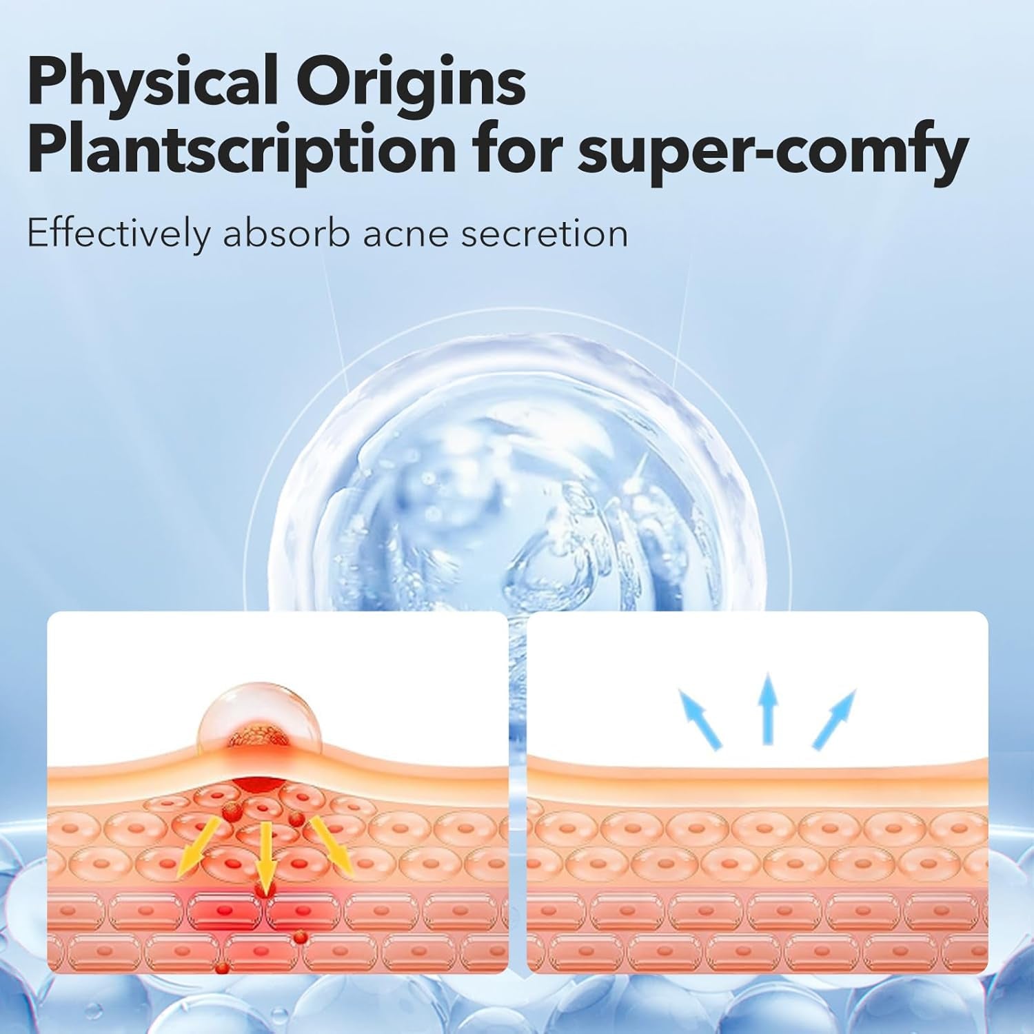 Pimple Patches for Face, Hydrocolloid Acne Patches, Cute round Shape Zit Covers, Spot Stickers with Tea Tree, Salicylic Acid & Cica Oil| 2 Sizes (9Mm, 12Mm) |288 Count