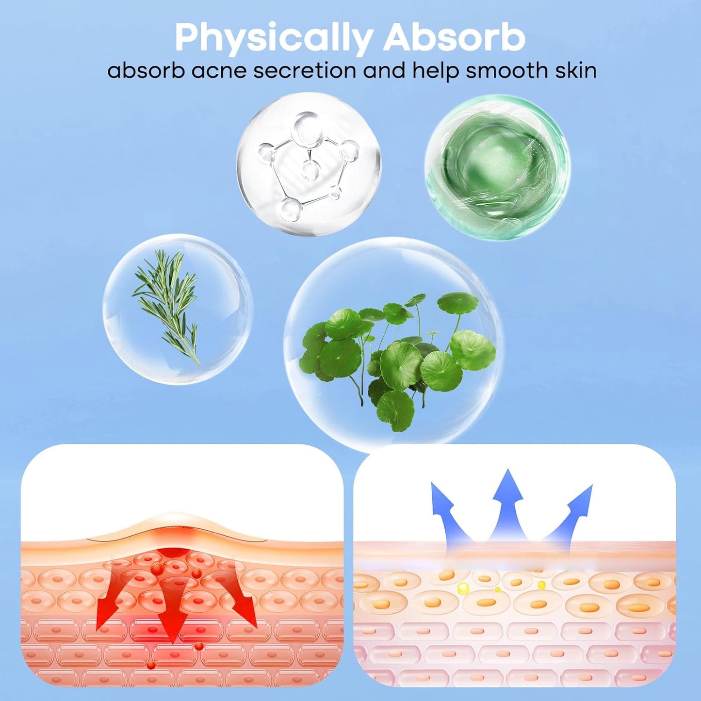 Large Pimple Patches for Face 331 Patches-7 Size,306 Patches round & 25 XL Acne Patches,Zit Patches Skin Care Hydrocolloid Pimple Patch with Tea Tree, Salicylic Acid & Cica Oil | Bigpack&Larger Size