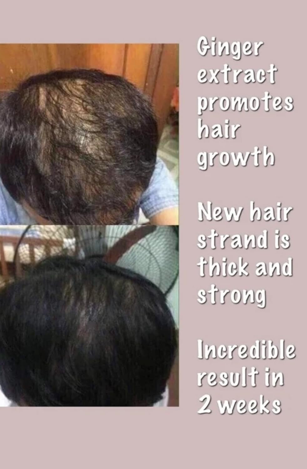 Ginger Zingiber Officinale Juice Prevent Hair Loss Stimulate Hair Growth Shampoo & Conditioner Mini Set TLBH