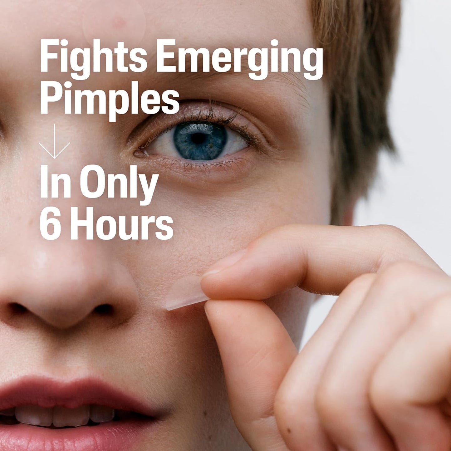 Acne Patches, Pimple Patches for Sensitive Skin, Formulated with Salicylic Acid, CICA, and Heartleaf Extract for Emerging Pimples, Visible Results in 6 Hours, 24 Count