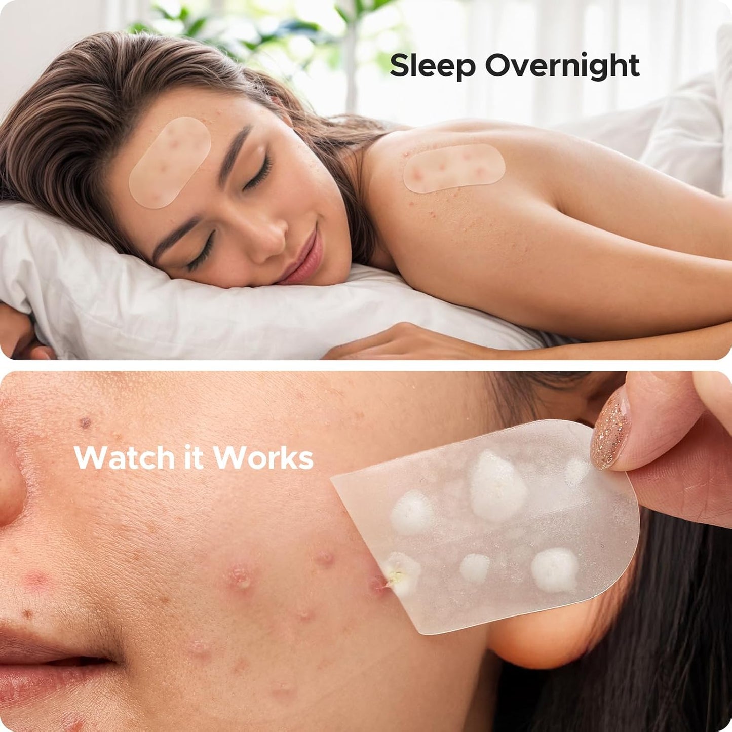 Large Pimple Patches for Face, 60 X 30 Mm XL Acne Patches, Big Hydrocolloid Bandages for Body, Back, Forehead, Chin, Neck Blemish Zit Breakouts (Oval, Square, Dot 5 Sizes 124 Count)