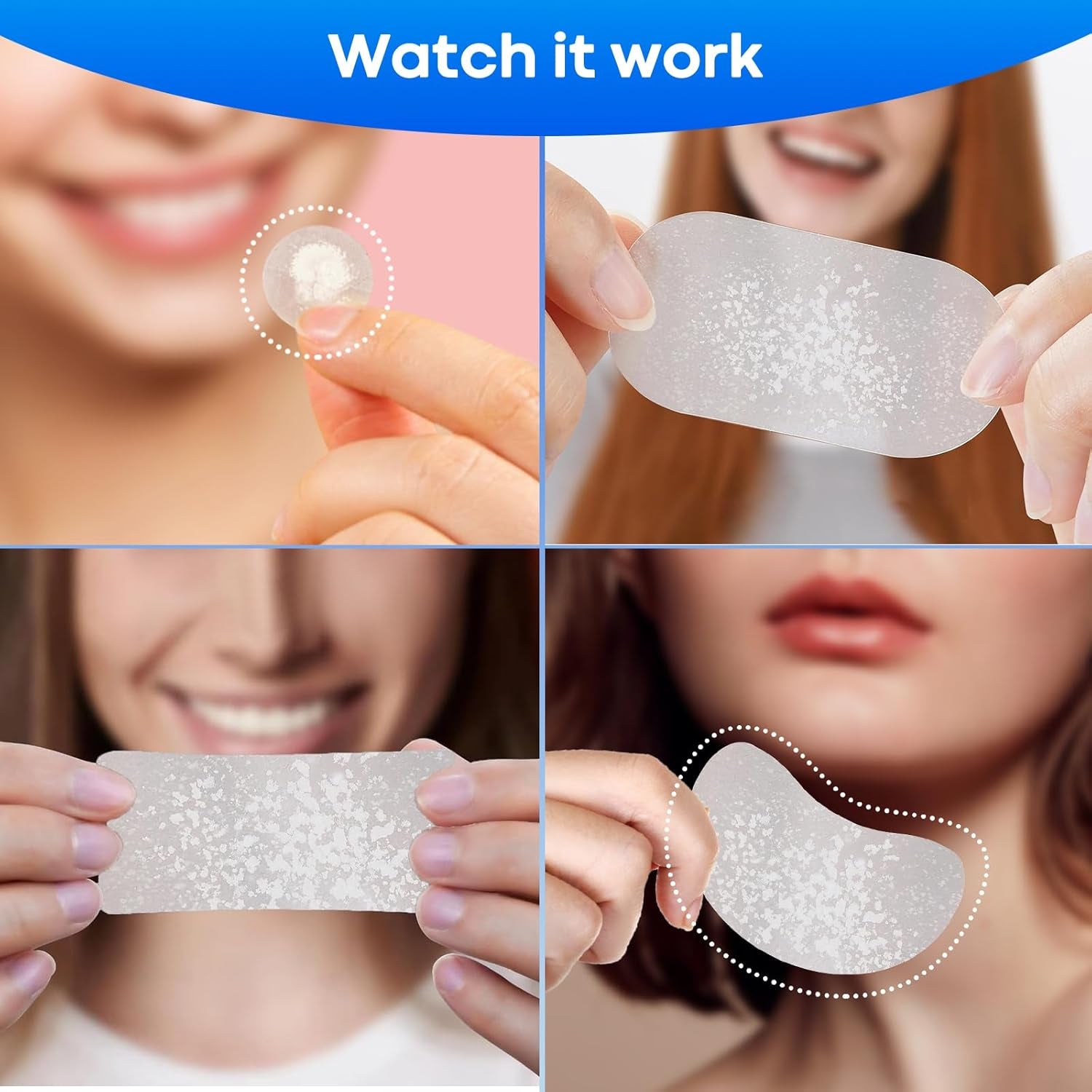 Large Pimple Patches for Face 331 Patches-7 Size,306 Patches round & 25 XL Acne Patches,Zit Patches Skin Care Hydrocolloid Pimple Patch with Tea Tree, Salicylic Acid & Cica Oil | Bigpack&Larger Size