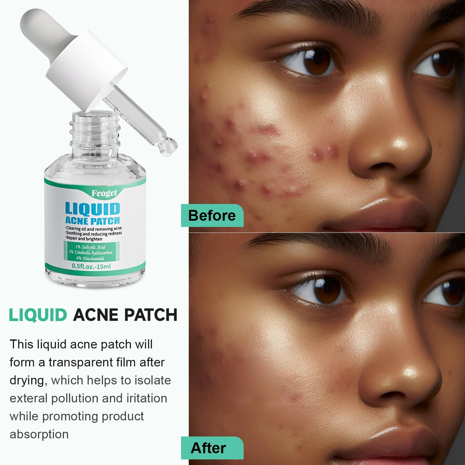 Acne Spot Treatment Serum for Face, with 2% Salicylic Acid & 4% Niacinamide Face Serum, Liquid Pimple Patch for Acne Prone Skin, Soothing Redness, Clearing Oil Skin Care for Teens & Adults