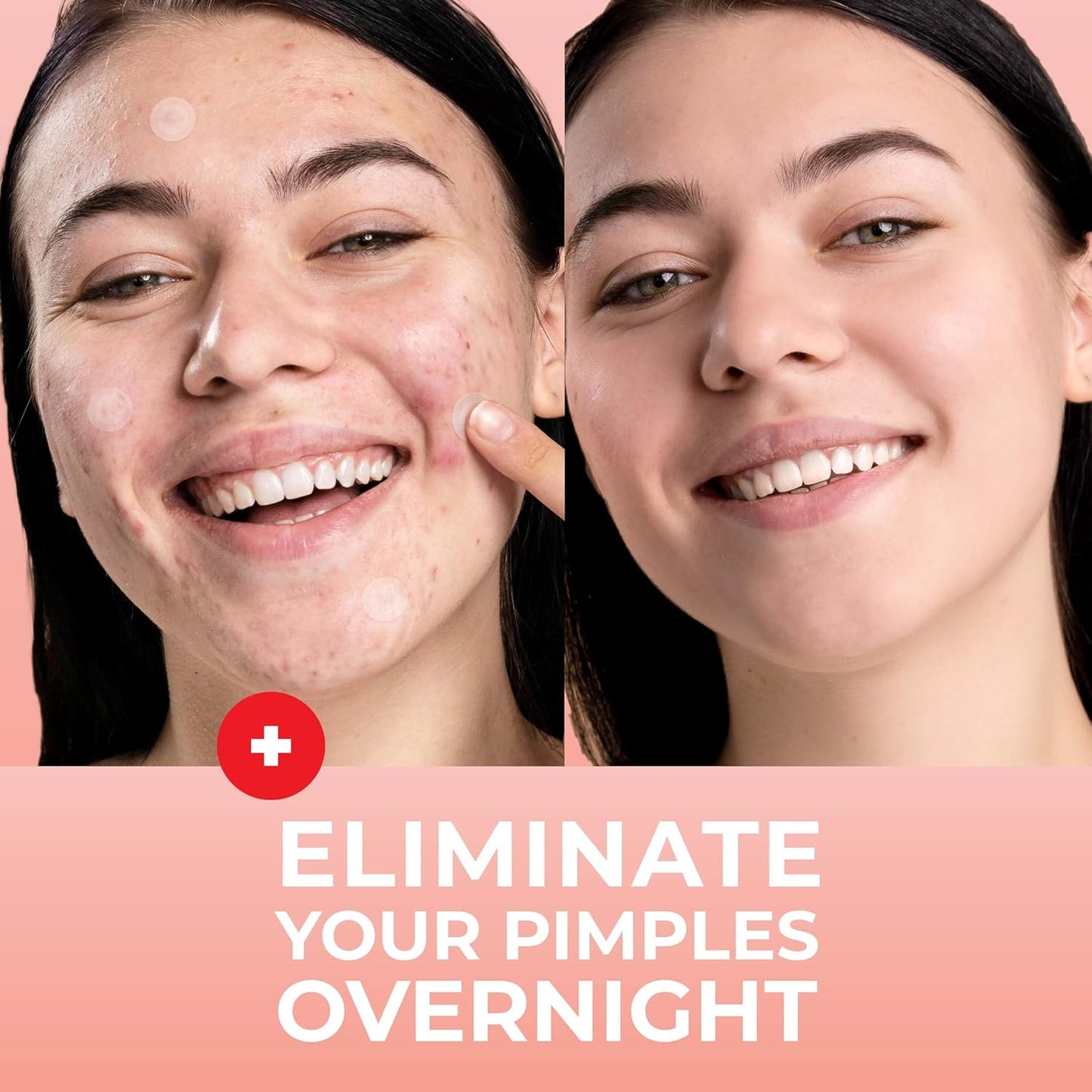 Micro Needle Pimple Patch (18 Pack) - Hydrocolloid Micropoint Pimple Patch for Acne & Cystic Pimples, Eliminate Pimples Overnight, Microdart Pimple Patch, Micro Dart Pimple Patches