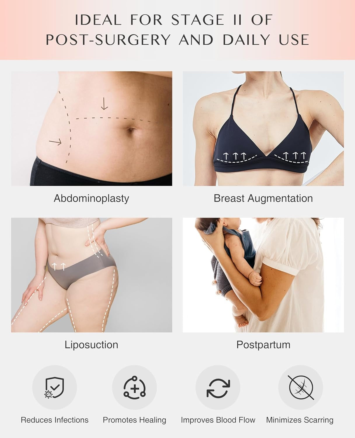 Fajas Colombianas Moldeadoras Shapewear BBL for Women Tummy Control Stage 2 Post Surgery Compression Garment