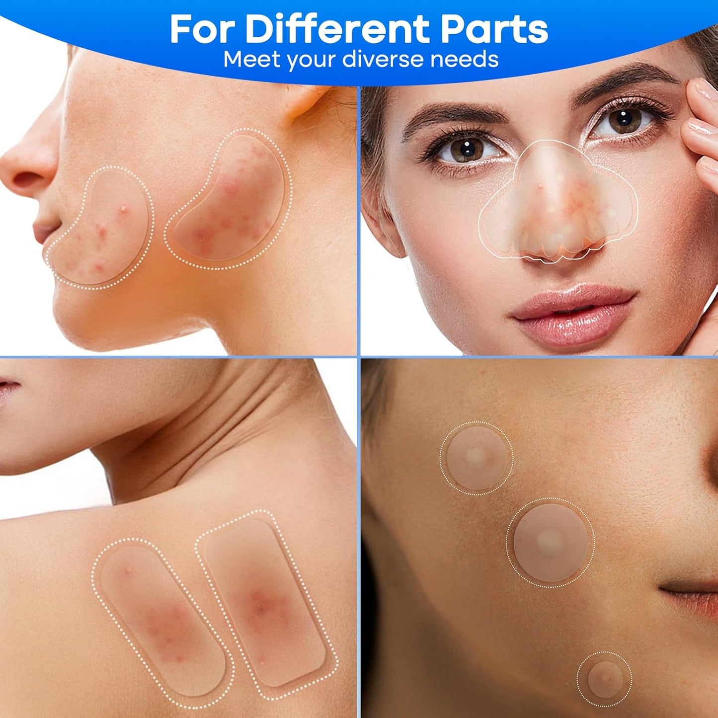 Large Pimple Patches for Face 331 Patches-7 Size,306 Patches round & 25 XL Acne Patches,Zit Patches Skin Care Hydrocolloid Pimple Patch with Tea Tree, Salicylic Acid & Cica Oil | Bigpack&Larger Size