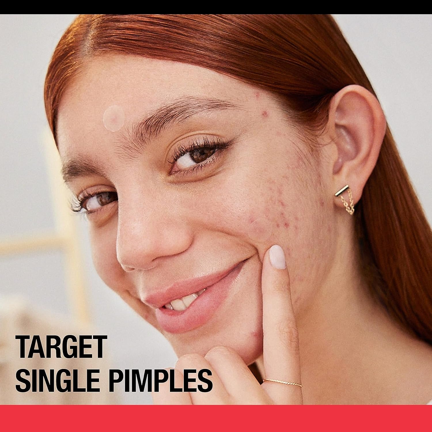 Stubborn Acne Pimple Patches, Acne Treatment for Face, Ultra-Thin Hydrocolloid Spot Stickers Provide Optimal Healing for Pimples, 24 Patches