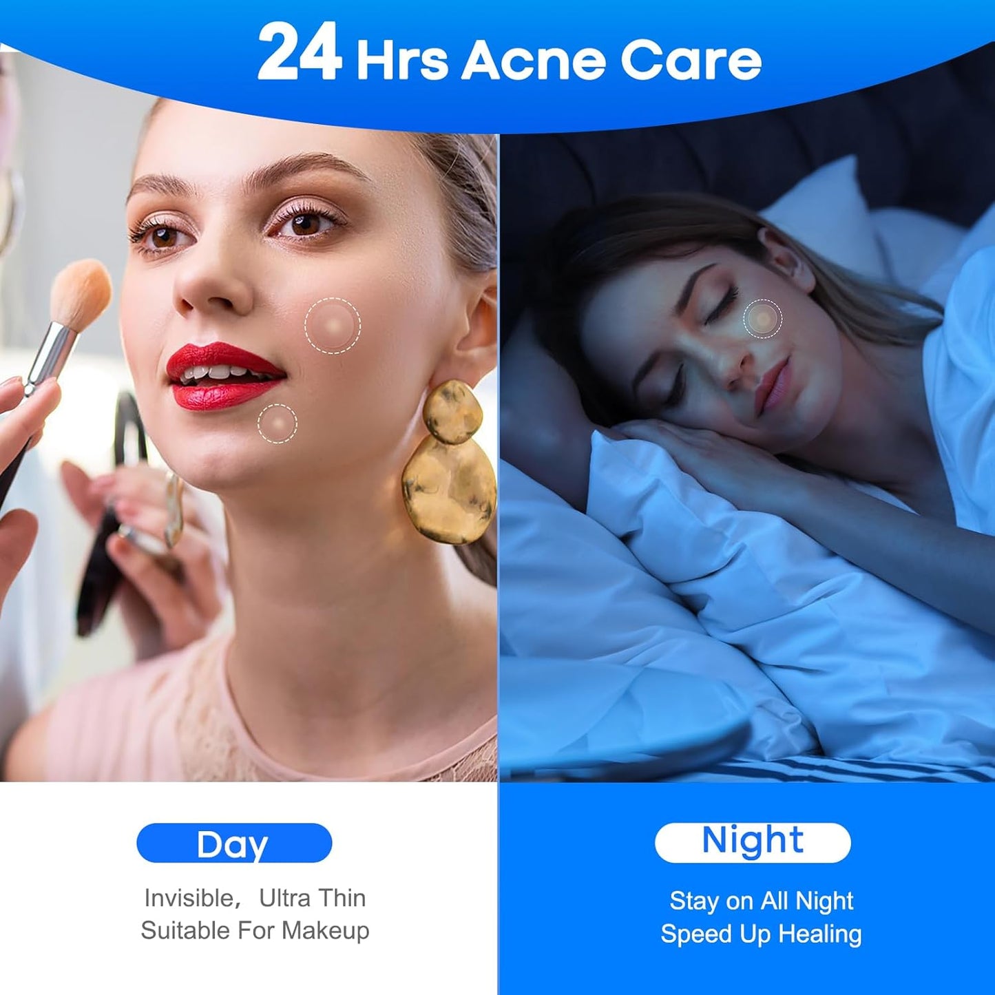 Large Pimple Patches for Face 331 Patches-7 Size,306 Patches round & 25 XL Acne Patches,Zit Patches Skin Care Hydrocolloid Pimple Patch with Tea Tree, Salicylic Acid & Cica Oil | Bigpack&Larger Size