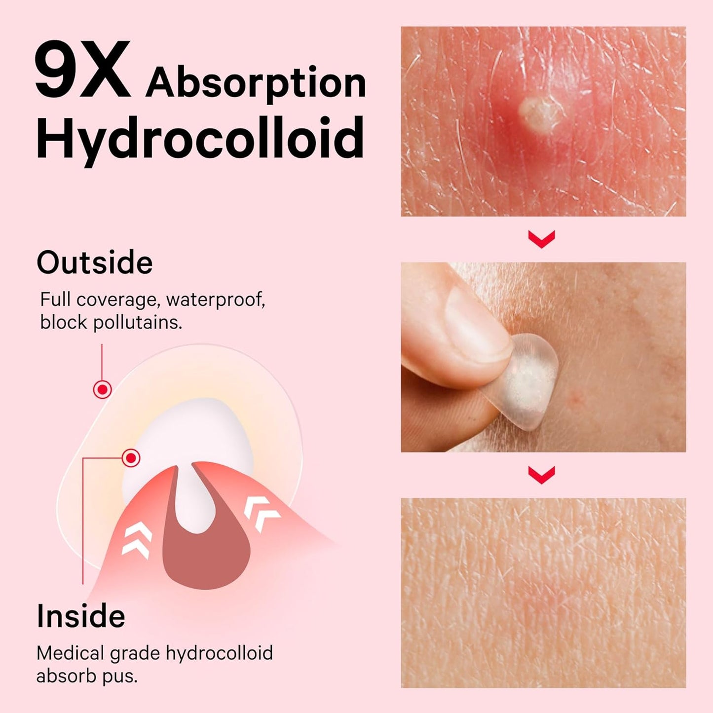 Pimple Patches for Face, FSA HSA Eligible Invisible Hydrocolloid Acne Patches, Zit Sticker for Face and Skin, Pimple Sticker for Covering Zits, Blemishes with Salicylic Acid 48 Count