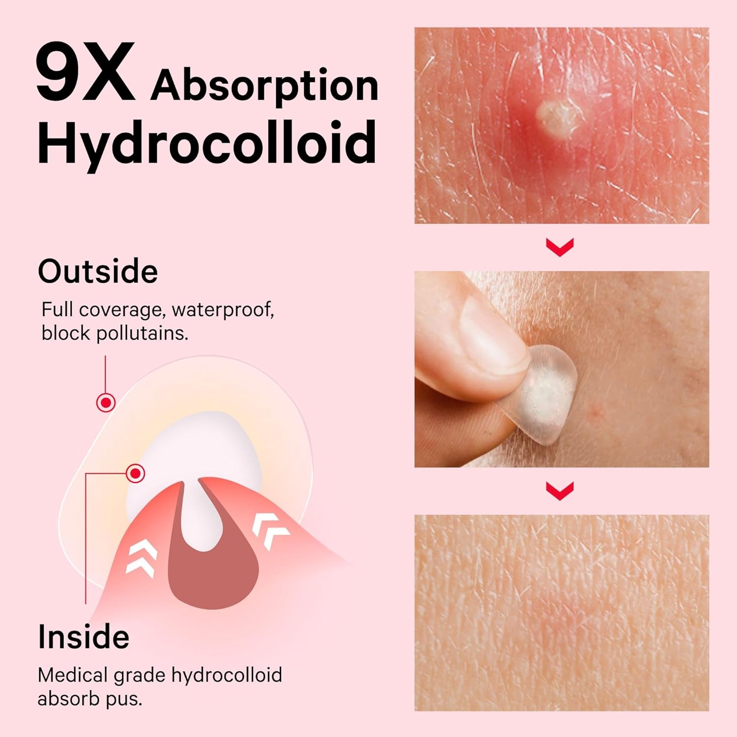 Pimple Patches for Face, FSA HSA Eligible Invisible Hydrocolloid Acne Patches, Zit Sticker for Face and Skin, Pimple Sticker for Covering Zits, Blemishes with Salicylic Acid 48 Count