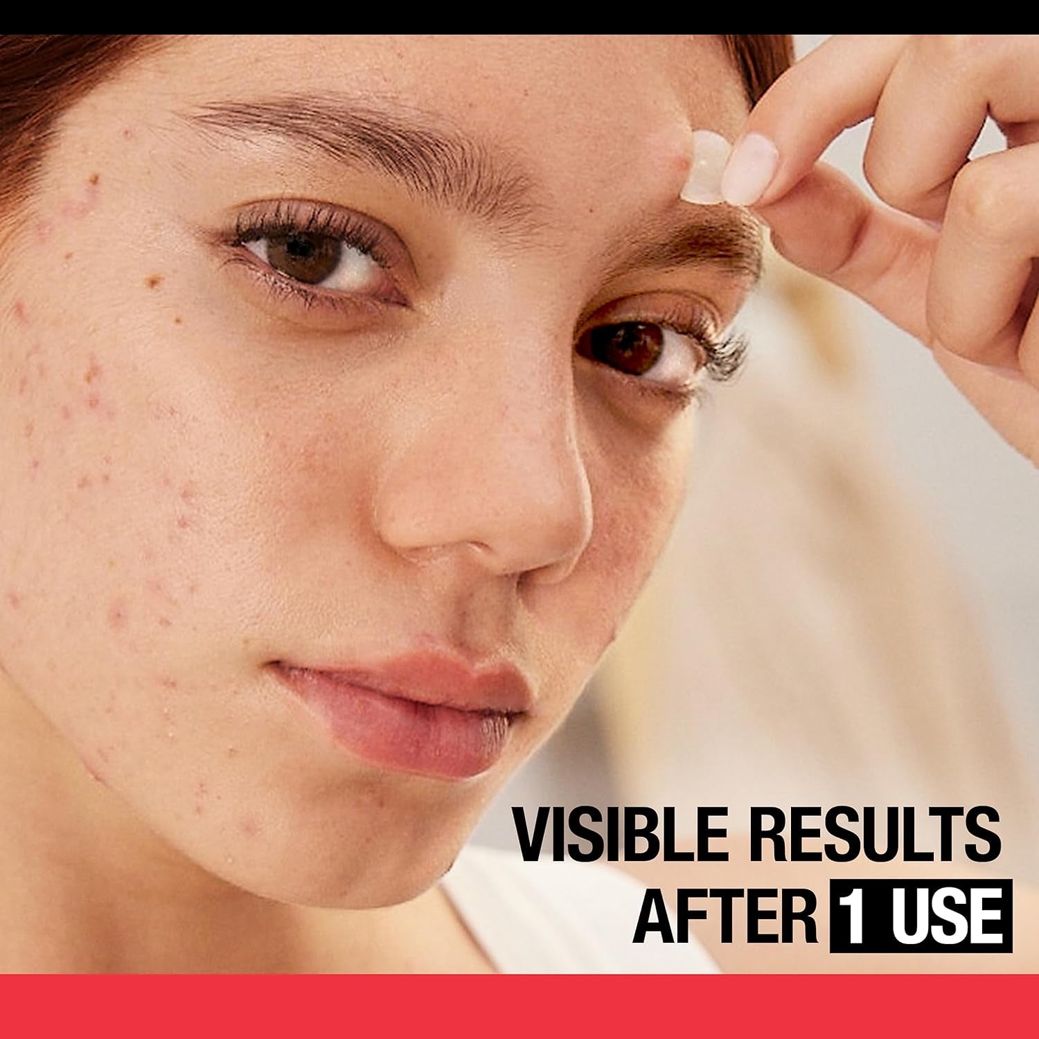 Stubborn Acne Pimple Patches, Acne Treatment for Face, Ultra-Thin Hydrocolloid Spot Stickers Provide Optimal Healing for Pimples, 24 Patches