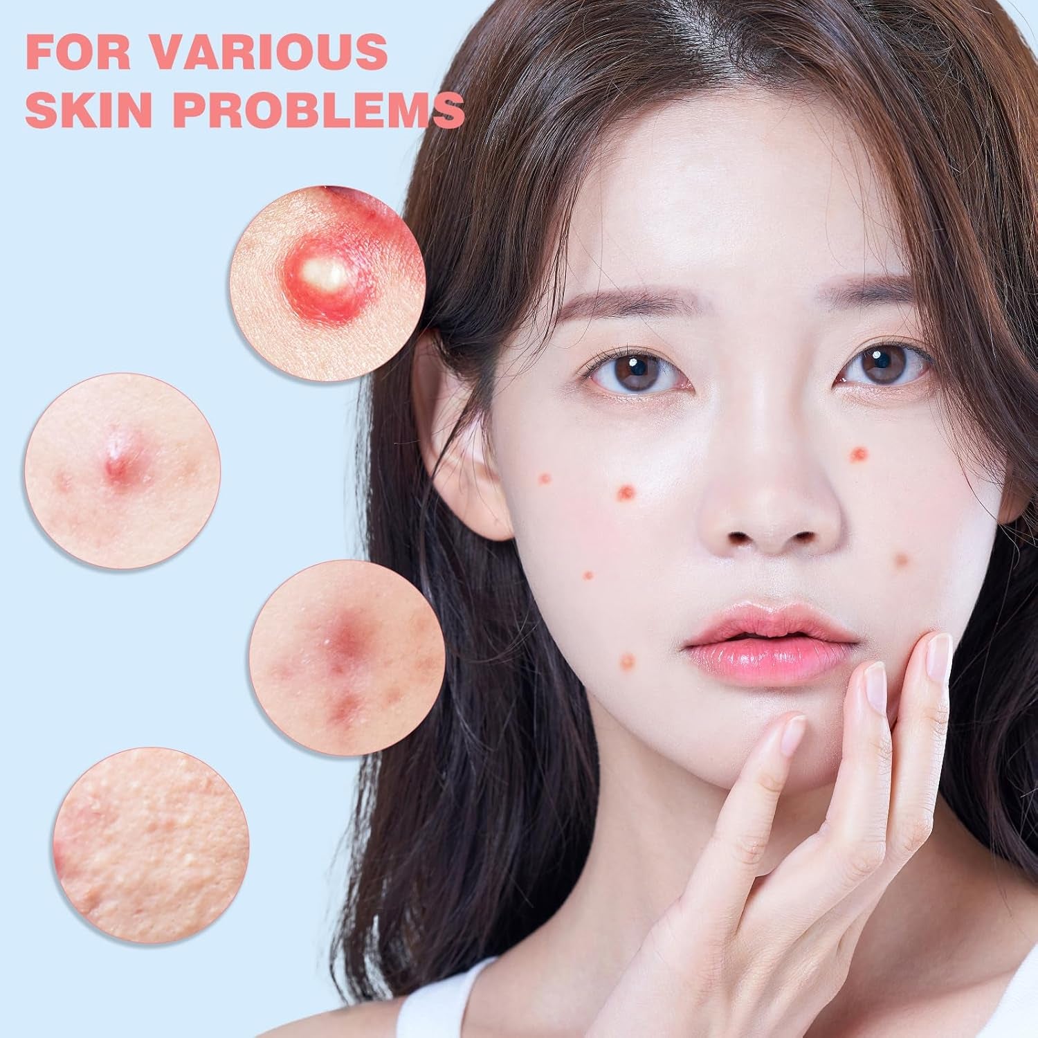 Pimple Patches for Face 280PCS, Hydrocolloid Acne Patches for Covering Zits and Blemishes, Cute Star Pimple Patches, Facial Skin Care Products.