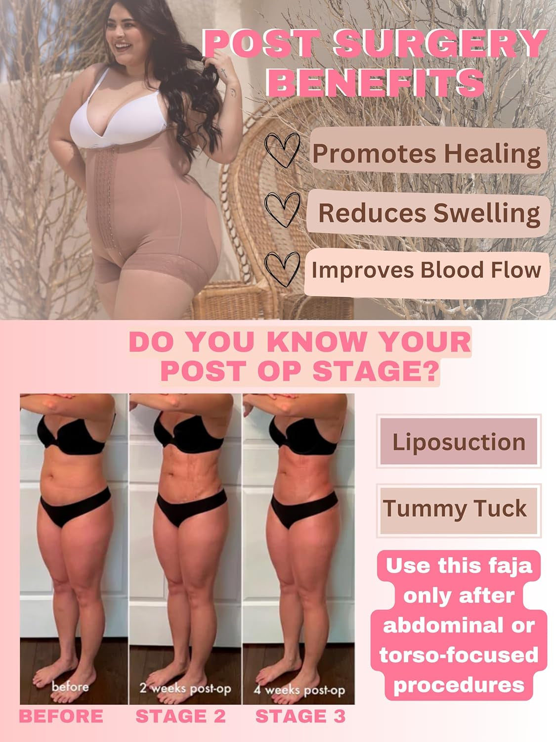 S66 Stage 2 Faja Post Surgery Tummy Tuck BBL Lipo Compression Garment for Women