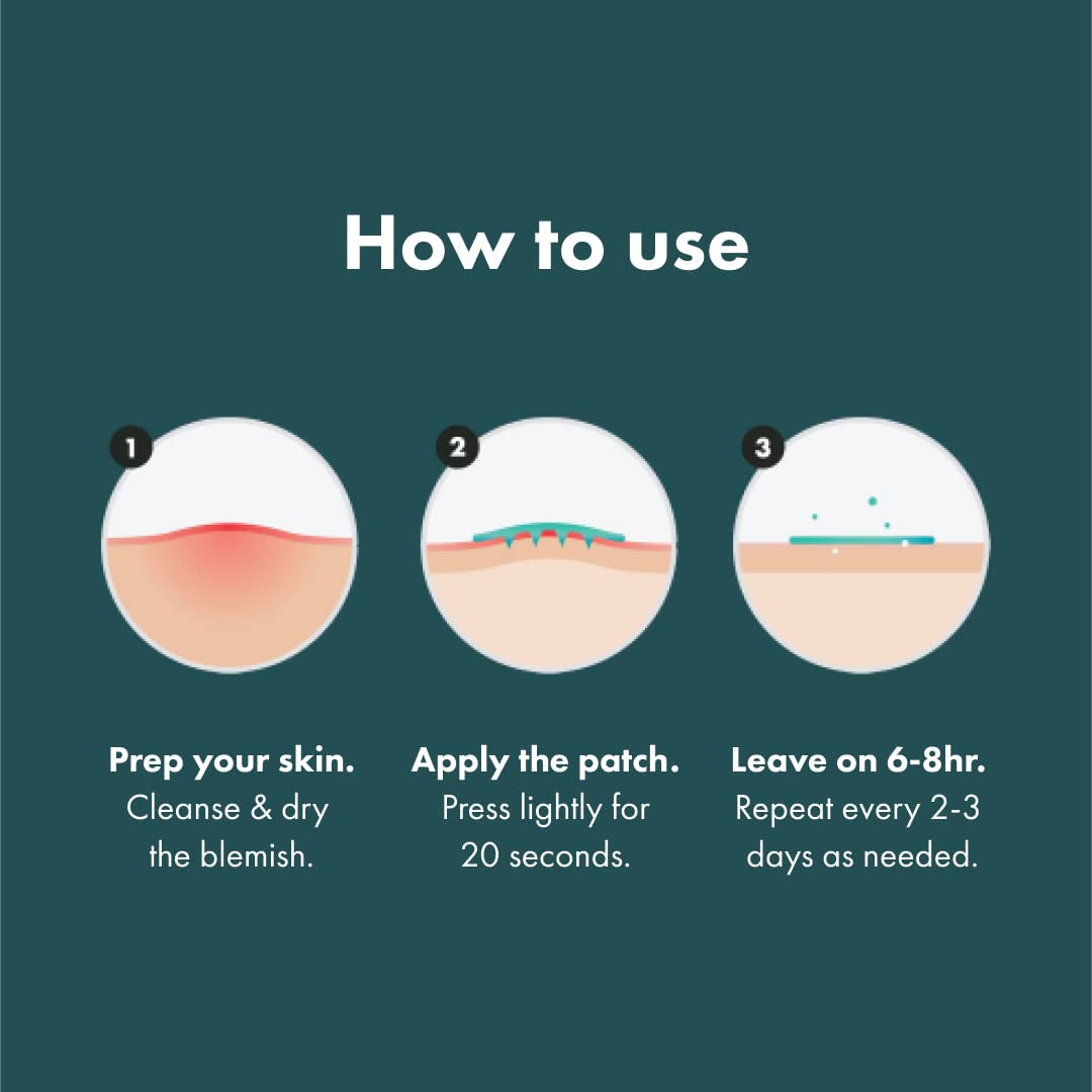 Micropoint™ for Blemishes from  - Hydrocolloid Acne Spot Treatment Patch for Early Stage Zits and Hidden Pimples, 395 Micropoints (8 Patches)