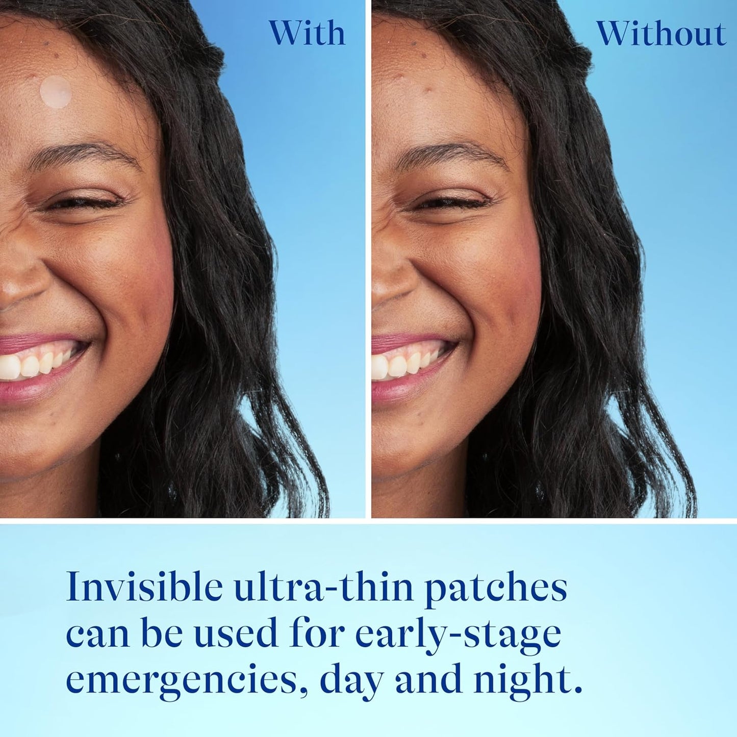 Acne Patches, Pimple Patches for Acne Prone Skin, Formulated with Salicylic Acid and Centella, Fast Triple Action Power Patch for Day & Night, Dermatologist Tested, 36 Count