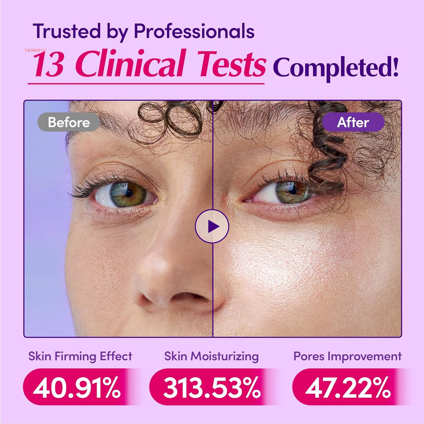 Bakuchiol Plumping Serum – Pore and Wrinkle Minimizer with Bakuchiol | Retinol Alternative for Sensitive Skin | Enhances Firmness and Elasticity with Ceramide and Peptides, 1.01Oz / 30Ml