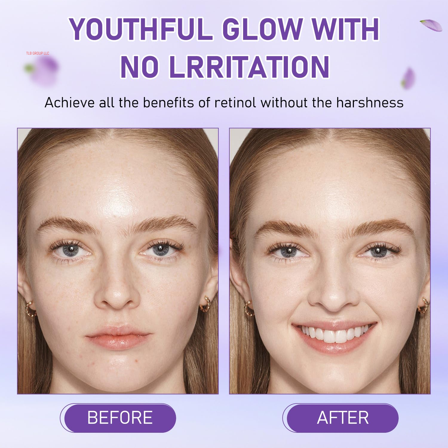 Bakuchiol Oil Organic, Natural Bakuchiol Serum for Face, Vegan Retinol Alternative with Squalane, Sensitive Skin Safe Soothes Irritated Skin, Reduces Fine Lines, Wrinkles(2Pcs- 2 Fl.Oz)