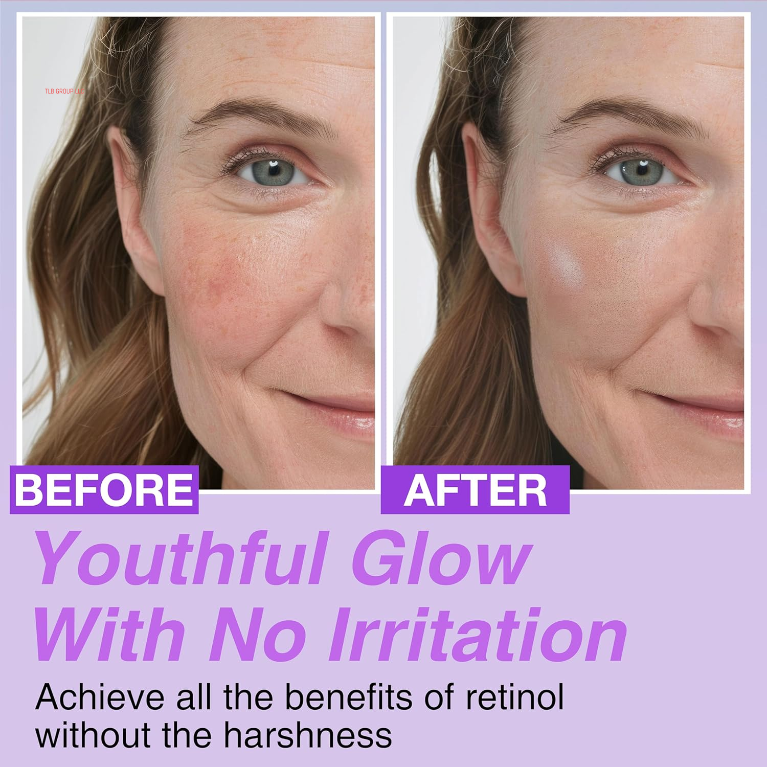 Korean Bakuchiol Concentrate DIY Mix-In Serum 30,000 Ppm - High Potency Retinol Alternative | Wrinkle Reduction Skin Firming & Smoothing - Anti-Aging Sensitive Skin Vegan & Cruelty-Free Non-Gmo 1 Oz